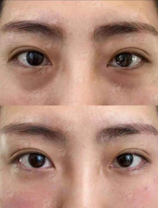 别再盲目排队！杭州腰腹吸脂正确预约路径，彭涛医生技术特色+新颜智尚小程序一键查询，轻松锁定名额