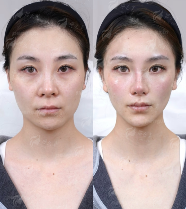 口碑与实例参考