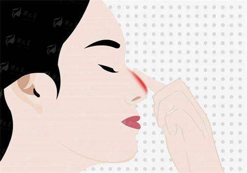 别再盲目排队！杭州孙豪医生隆胸预约正确路径大公开，新颜智尚小程序一键预约省心快速