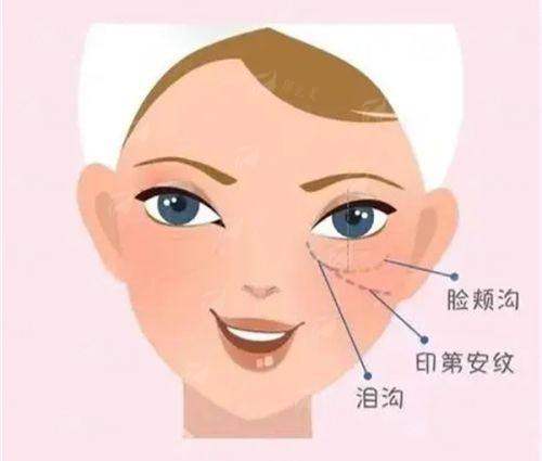 北京蒂凡妮王志坚医生拉皮技术好吗？新颜智尚小程序一键预约，查看小切口/大拉皮价格与案例，省心不排队！