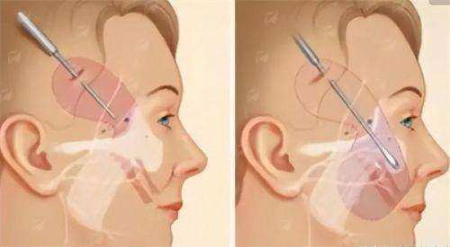 新乡弈诺美医疗美容诊所超皮秒效果怎么样？医生团队及预约电话-24小时新颜智尚小程序预约