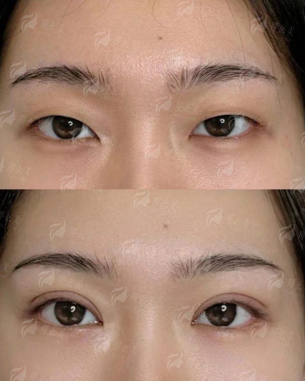 成都黄伟医生面部年轻化做得好吗？新颜智尚小程序一键预约省心快速，价格费用与特色技术一篇说清！