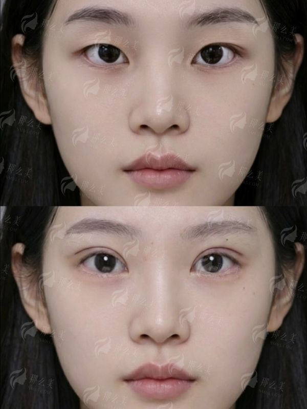 外地如何高效预约熊猛隆胸？内窥镜双平面技术亮点与医院特色介绍，新颜智尚小程序预约省心快速，攻略在此！