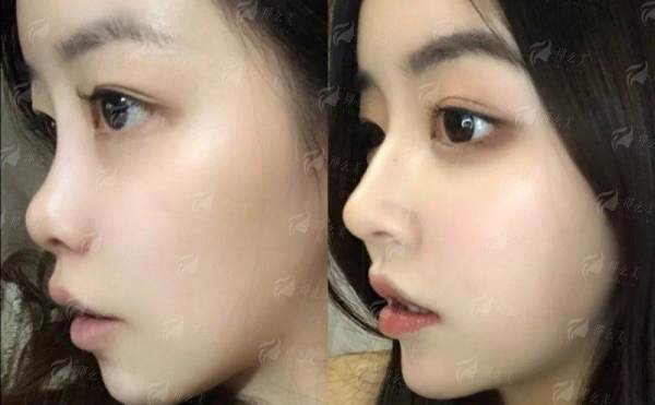 宝子们冲！濮阳时光医疗美容医院石付强做鼻综合好吗？5分钟看懂医生特色与避坑指南，新颜智尚小程序一键查询预约方式大公开