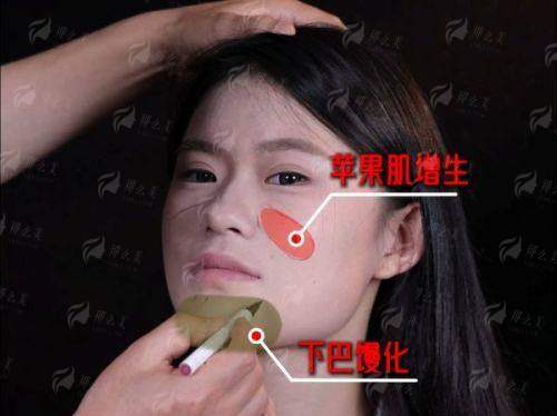 <strong>患者真实评价与口碑：大家如何评价苏州高建朋医生？</strong>