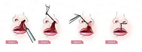 <strong>口碑与患者评价：真实反馈见真章</strong>
