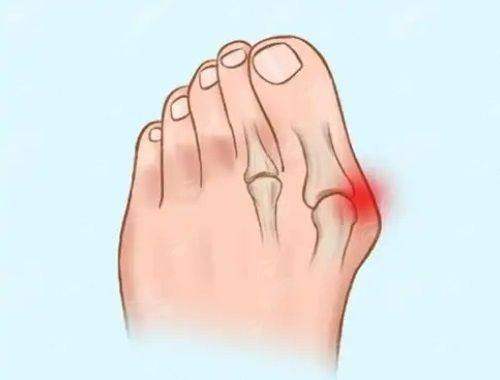 <strong style="color: rgb(255, 0, 0);">术后护理与真实口碑：成效持久的关键所在</strong>