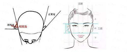 <strong>患者真实评价与口碑：朱苗医生注射技术成效反馈</strong>