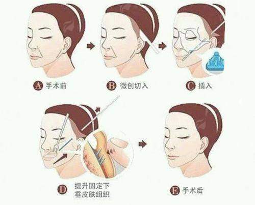 <strong>总结：为什么选择银川丽都马爱</strong>