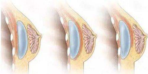 <strong style="color: rgb(255, 0, 0);">特色仪器与个性化方案：为成效加持的双重保护</strong>