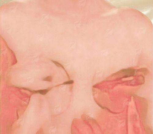 <strong>俞积贵医生的核心手术思路与技术优势详解</strong>