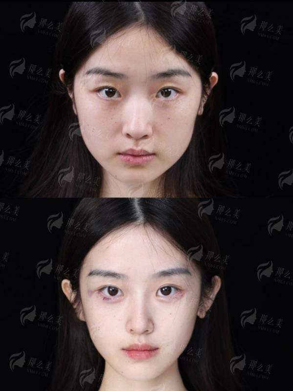 重庆军美隆胸怎么样？章小平院长胸部整形技术分析与价格参考｜新颜智尚小程序预约福利