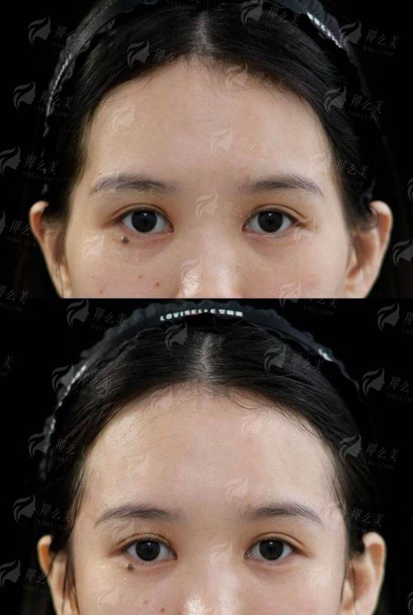 <strong>重庆军美隆胸特色治疗方式与仪器</strong>