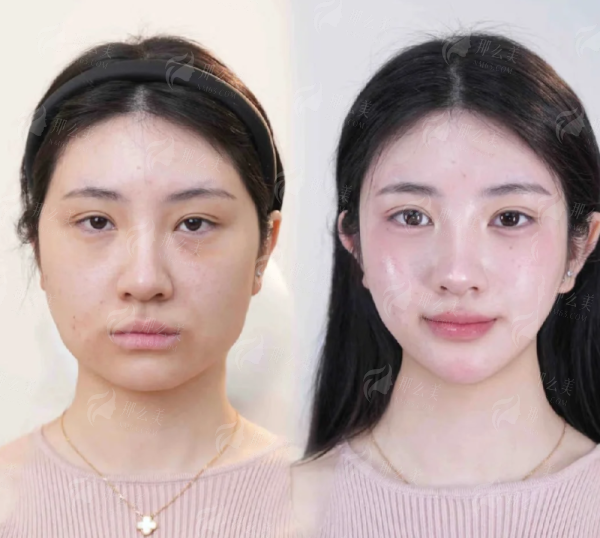 <strong>「银川丽都医疗美容医院马爱红主事眼鼻综合精细化整形」的特色仪器与治疗方式</strong>