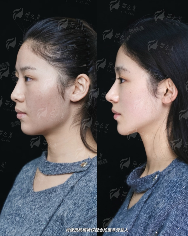 <strong>朱苗医生注射项目价格区间与收费标准是怎样的？</strong>