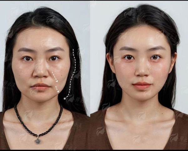 <strong>医院环境与服务：从面诊到术后护理的全流程关怀</strong>