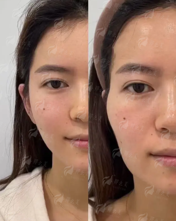 <strong style="color: rgb(255, 0, 0);">如何轻松预约？上新颜智尚小程序，一键锁定美丽档期</strong>