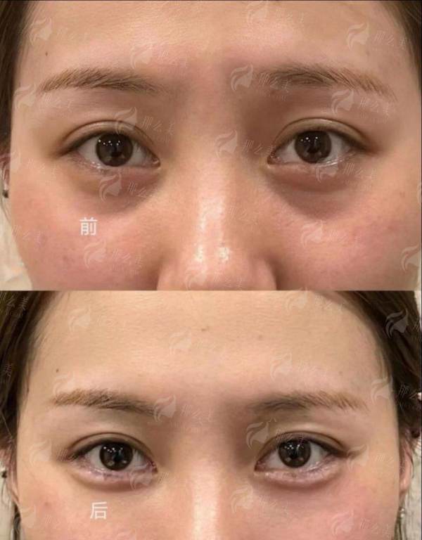 <strong>重庆做耳整形的价格区间与收费标准是怎样的？</strong>