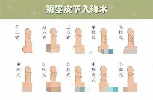 三、冯牧夷医生吸脂手术安心保护