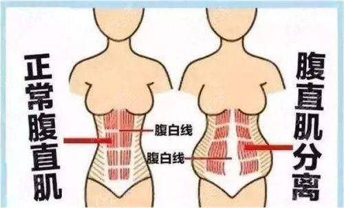 上海海华耳再造真实评价如何？技术+服务深度测评，造耳价格、恢复期全公开！新颜智尚一键预约省心快速