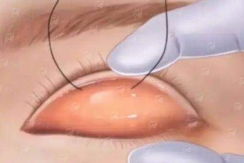 <strong>关于杭州维多利亚马康医生动态美眼技术，求美者更关心的价格与收费是怎样的？</strong>