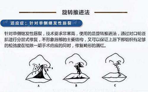 <strong>嘉兴韩辰骨干医生团队实力：技术不错，经验多</strong>