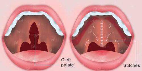 成都华生铂悦整形口碑如何？王欣大腿吸脂风格特点&预约攻略，价格案例一键查，新颜智尚小程序预约省心快速