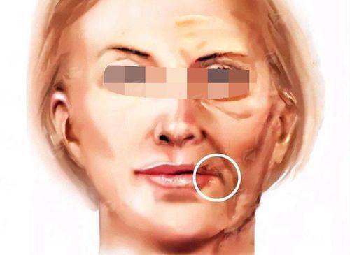 哈尔滨瑞丽医疗美容医院高峰双眼皮怎么样？5大技术特色揭秘，新颜智尚小程序一键预约，省心高效不白跑