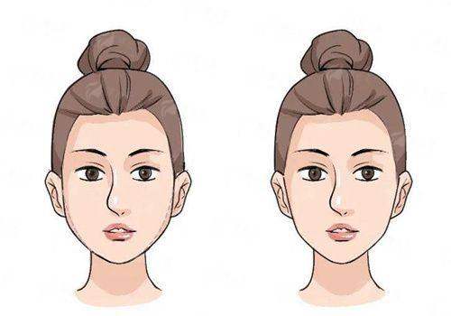 <strong>烟台华怡医学美容医院的骨干医生团队，为何是成效保护的关键？</strong>