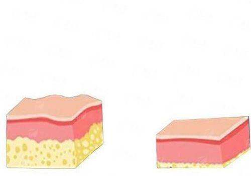 <strong>武汉紫荆医院项昌峰医生技术优势深度解析</strong>