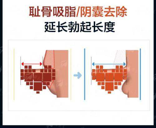 <strong>北京煤医西坝河医院拉皮手术的特色治疗方式与仪器</strong>