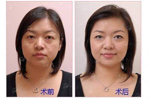 <strong>深度测评：从服务到环境，求美体验全流程解析</strong>