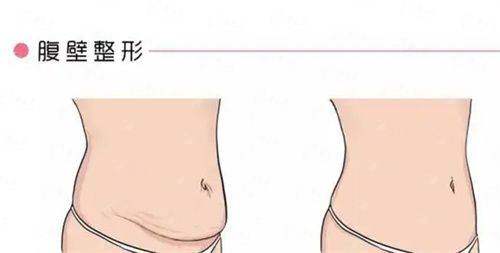 <strong>重庆眼部整形价格几何？2026年美仑美奂收费参考</strong>