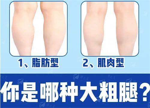 上海华美梦萦假体隆胸优势大揭秘！价格案例全知道，新颜智尚小程序一键预约省心快速