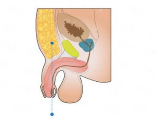 <strong>深度测评：特色项目与前列仪器如何强强联合？</strong>