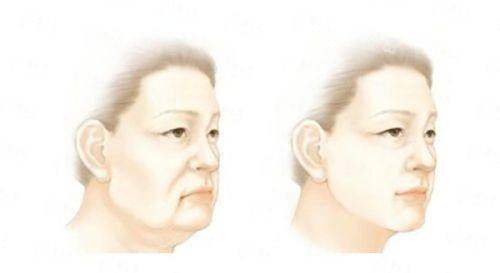 四、东莞美立方蜂巢皮秒价格体系