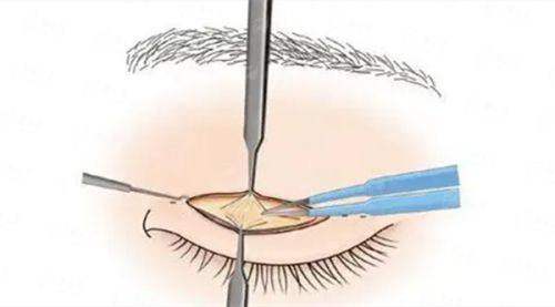 烟台华怡医学美容医院特色项目解析：超光子+水光联合焕肤效果与口碑如何？新颜智尚小程序可约，含乘车路线&医生简介