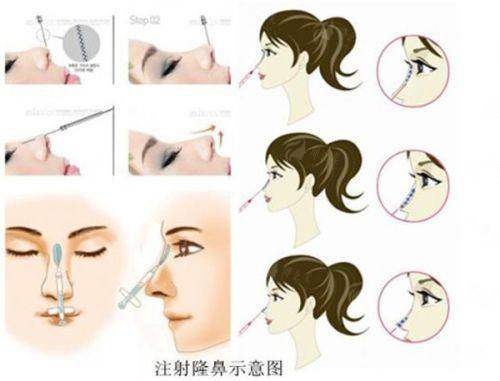 面部抗衰不踩坑！阜阳微悦吴双主任多维提拉预约方式大公开，新颜智尚小程序24小时一键预约。