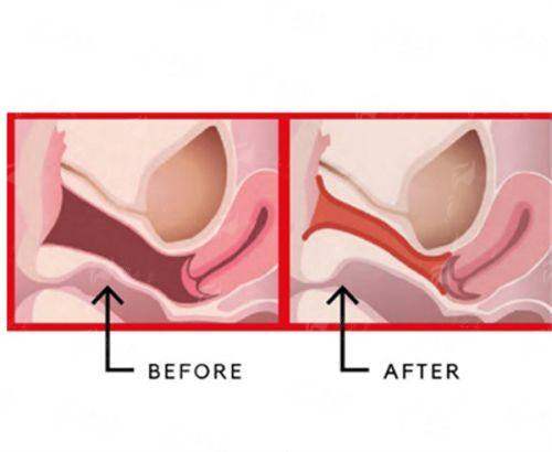 <strong>何为榫卯技术？它如何保护隆鼻的“真”与“活”？</strong>