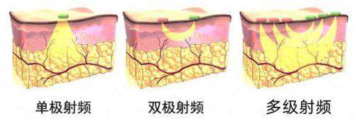 <strong>精细化眼综合项目价格区间及收费标准解析</strong>