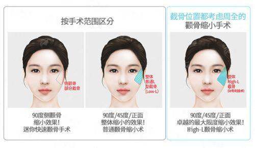 珠海宝子冲！珠海韩妃私密整形预约攻略来了，医生档期、地址导航全解析，新颜智尚小程序预约省心快速