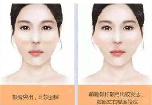 <strong>精灵耳做不好真的特别假！揭秘泉州亿星骨干医生团队的技术硬实力</strong>