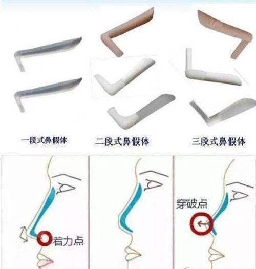 <strong>精灵耳做不好真的特别假！了解泉州亿星2026年价格区间与预约方式汇总</strong>