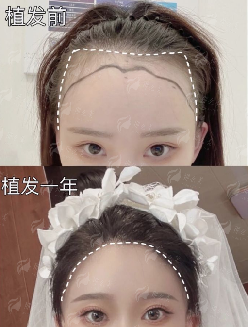 北京煤医西坝河拉皮手术价格表大公开！王驰医生风格优势与预约方式全解析，新颜智尚小程序一键查询