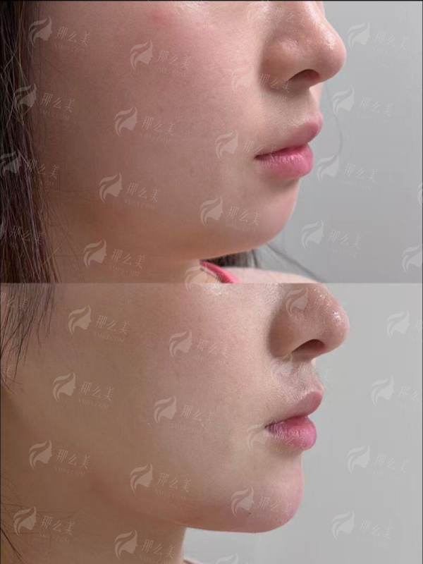 <strong>总结与行动指南：如何开启你的武汉韩辰变得更美之旅</strong>