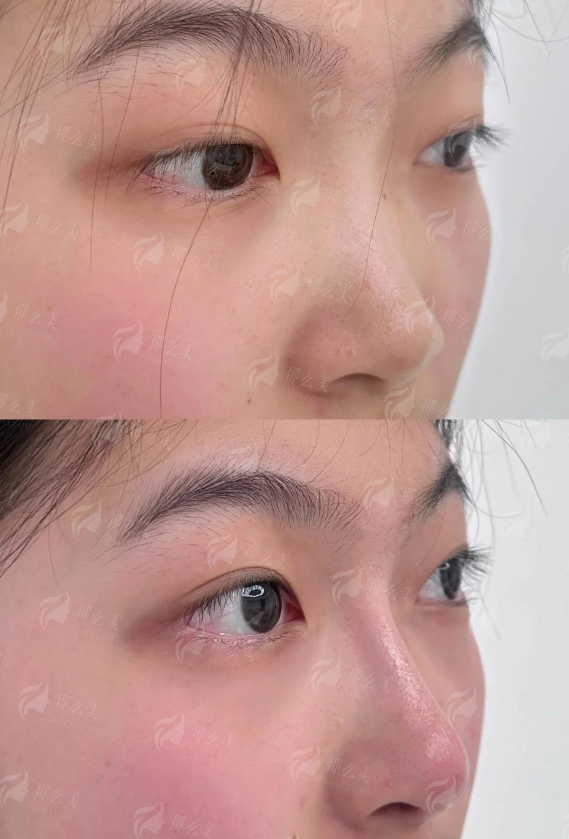 <strong>医院服务与术后护理：安心变得更美的坚实后盾</strong>