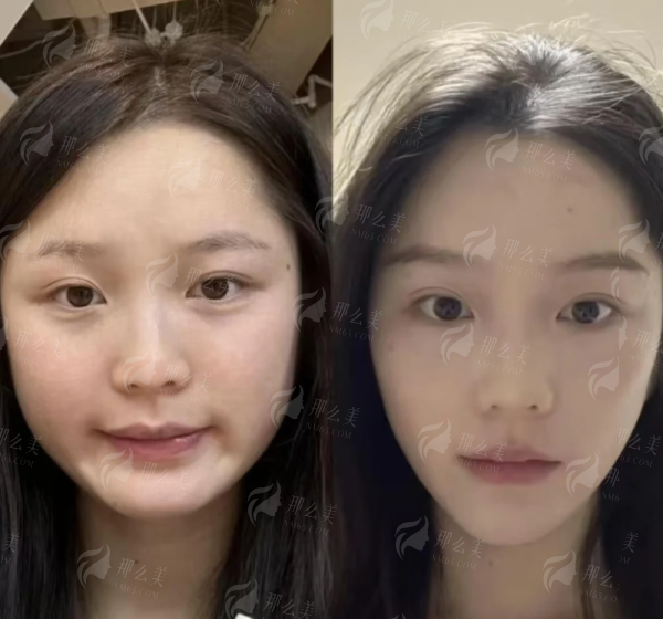 <strong>总结：从想找刘昭政隆鼻怎么预约到成功变得更美的完整路径</strong>