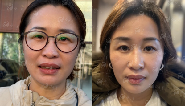 <strong>在烟台华怡做联合焕肤，体验与服务流程是怎样的？</strong>