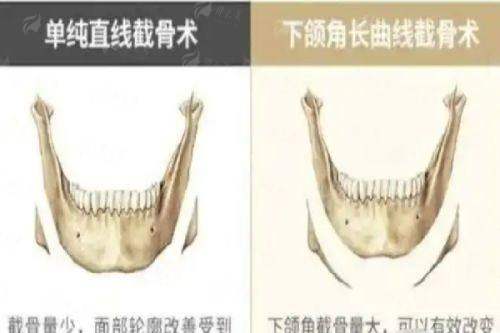 <strong>郑州她山医疗美容医院的服务与口碑如何？</strong>