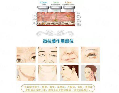 <strong>淮南华美甩掉下颌赘肉的特色治疗方式与仪器有哪些？</strong>